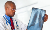 Tuberculosis in South Africa